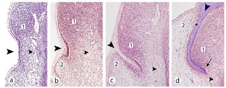Fetal Development of Clitoris and Prepuce